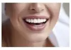 Förbättra ditt leende med kvalitets-estetisk tandvård i Stockholm